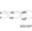 Barraquer Solid Blade Wire Speculums